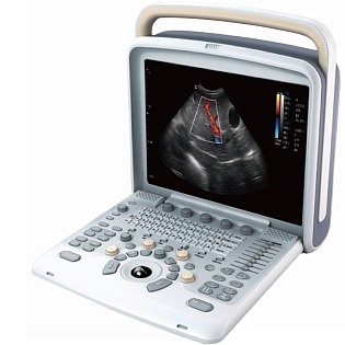 Chison SonoTouch (ST 50), (Ebit50),(ECO6) 