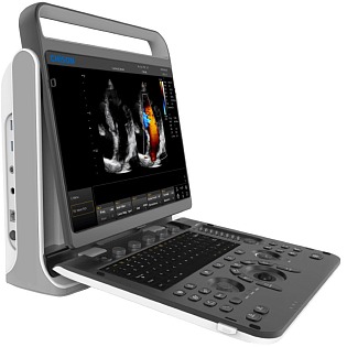 Chison SonoTouch 30 (ST30) 