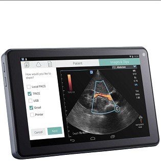 Fujifilm Sonosite iViz 