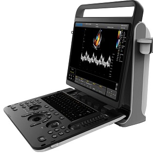 Chison SonoTouch 30 (ST30) 