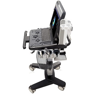 Chison SonoTouch 30 (ST30) 