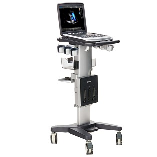 Chison SonoTouch 80 EXP, (ST 80 EXP) (SonoBook 9) 