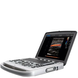 Chison SonoTouch 80 EXP, (ST 80 EXP) (SonoBook 9) 